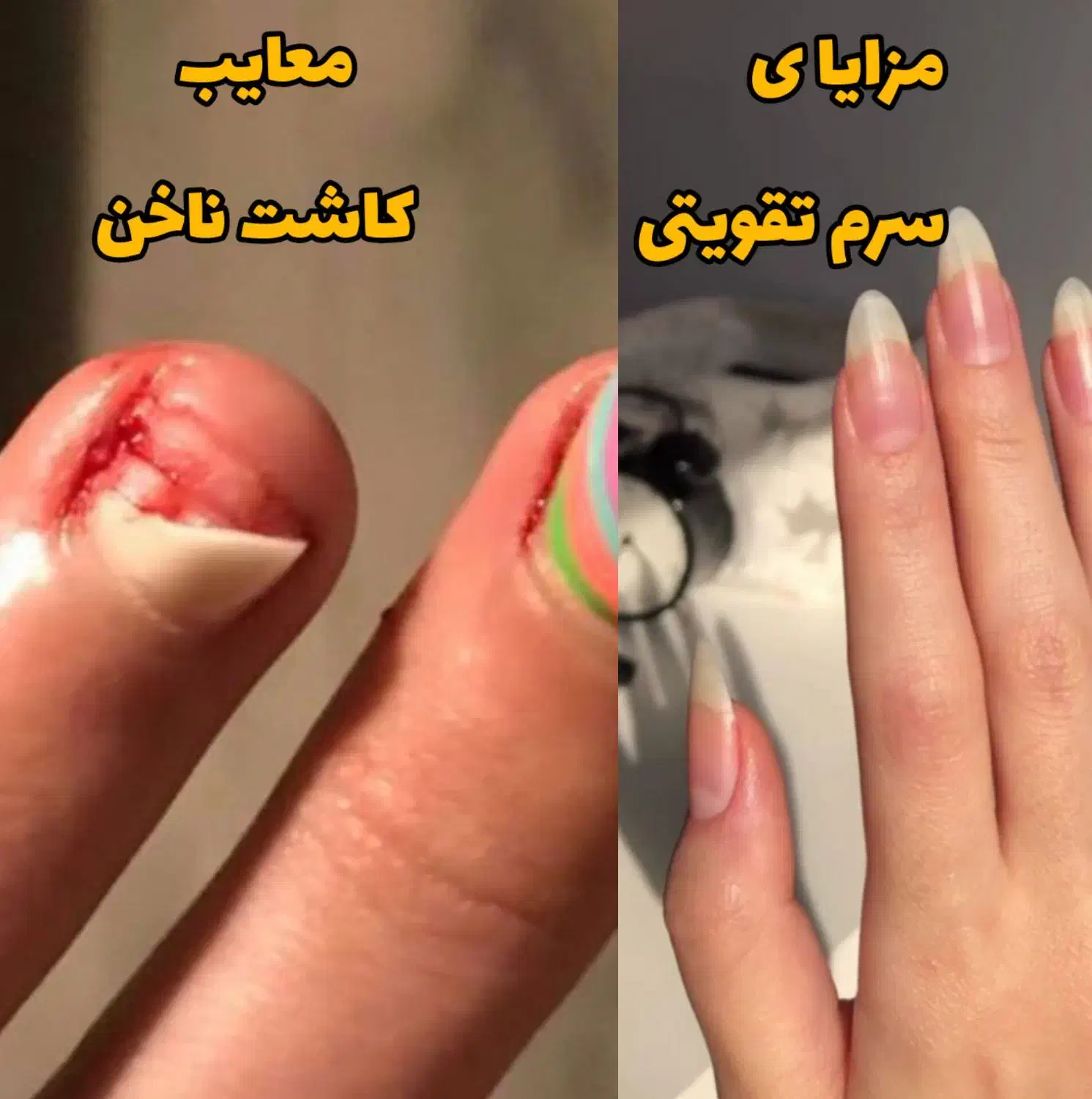 سرم تقویت ناخن اصل نمایندگی بردسیر|آرایشی، بهداشتی، درمانی|بردسیر, |دیوار