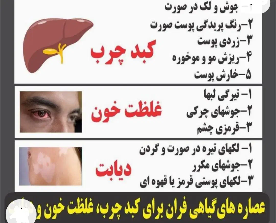 بهبود کبد چرب|خدمات آرایشگری و زیبایی|درگهان, |دیوار