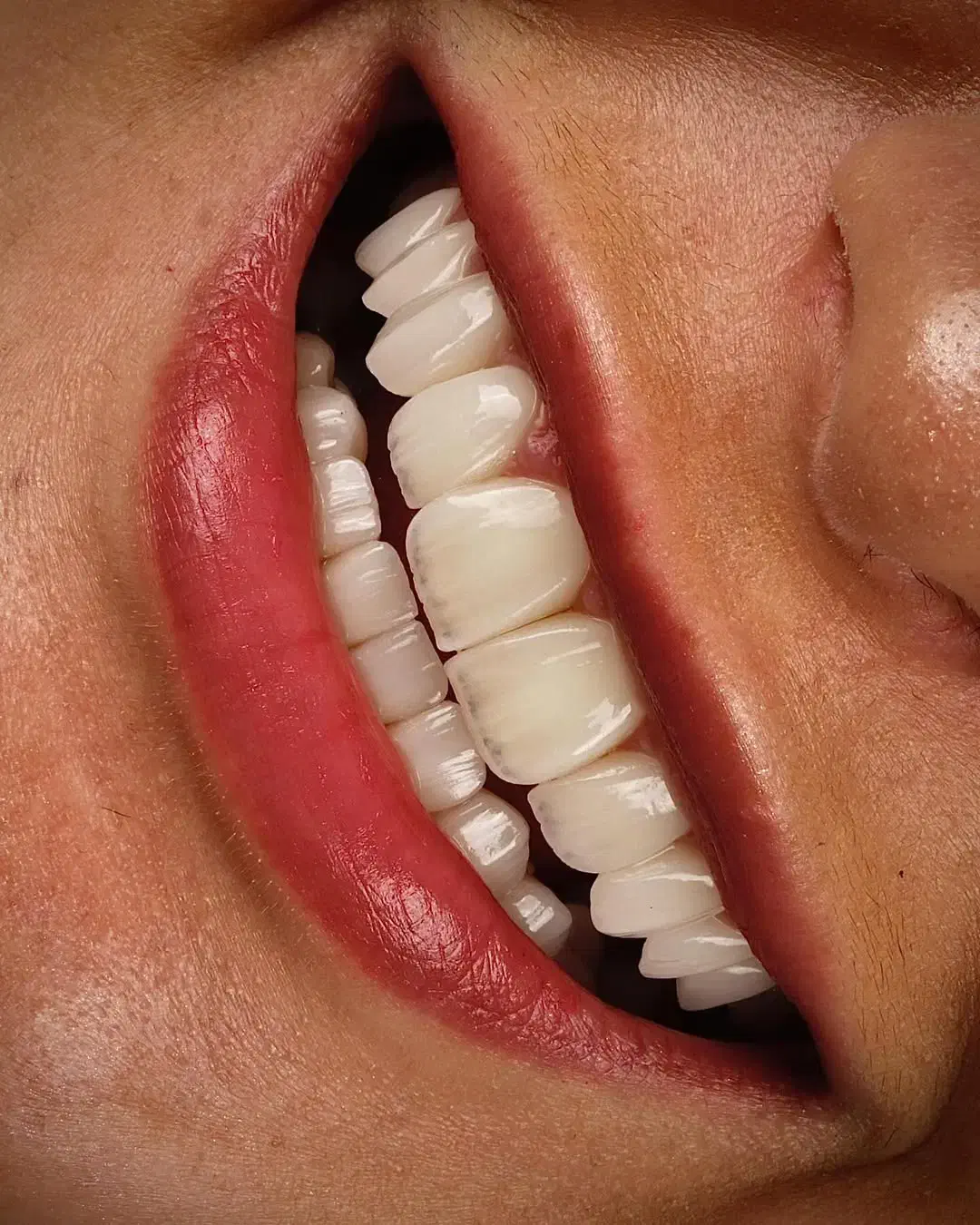 لابراتوار دندان سازی/ترمیم انواع دندان شکسته|خدمات آرایشگری و زیبایی|کرج, حصارک پایین|دیوار