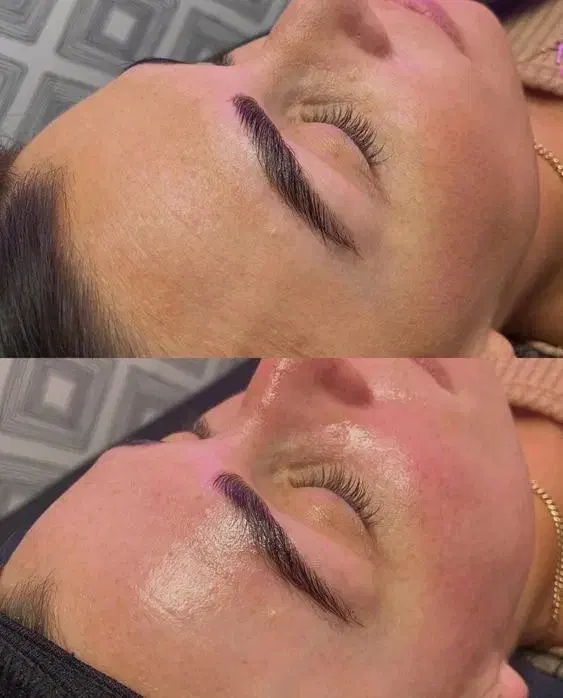 خروج لک و کک مک جای جوش با درمان تلفیقی|خدمات آرایشگری و زیبایی|سبزوار, کاشفی شمالی (دادگستری)|دیوار