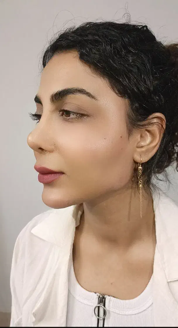 تزریق چربی ، فیلر بادی، ژل، بوتاکس در مطب|خدمات آرایشگری و زیبایی|شیراز, گویم|دیوار