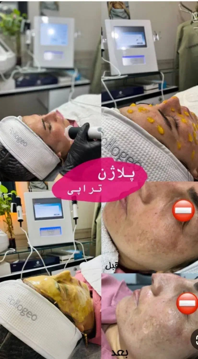 پوست زیبایی درخشش|خدمات آرایشگری و زیبایی|یاسوج, |دیوار