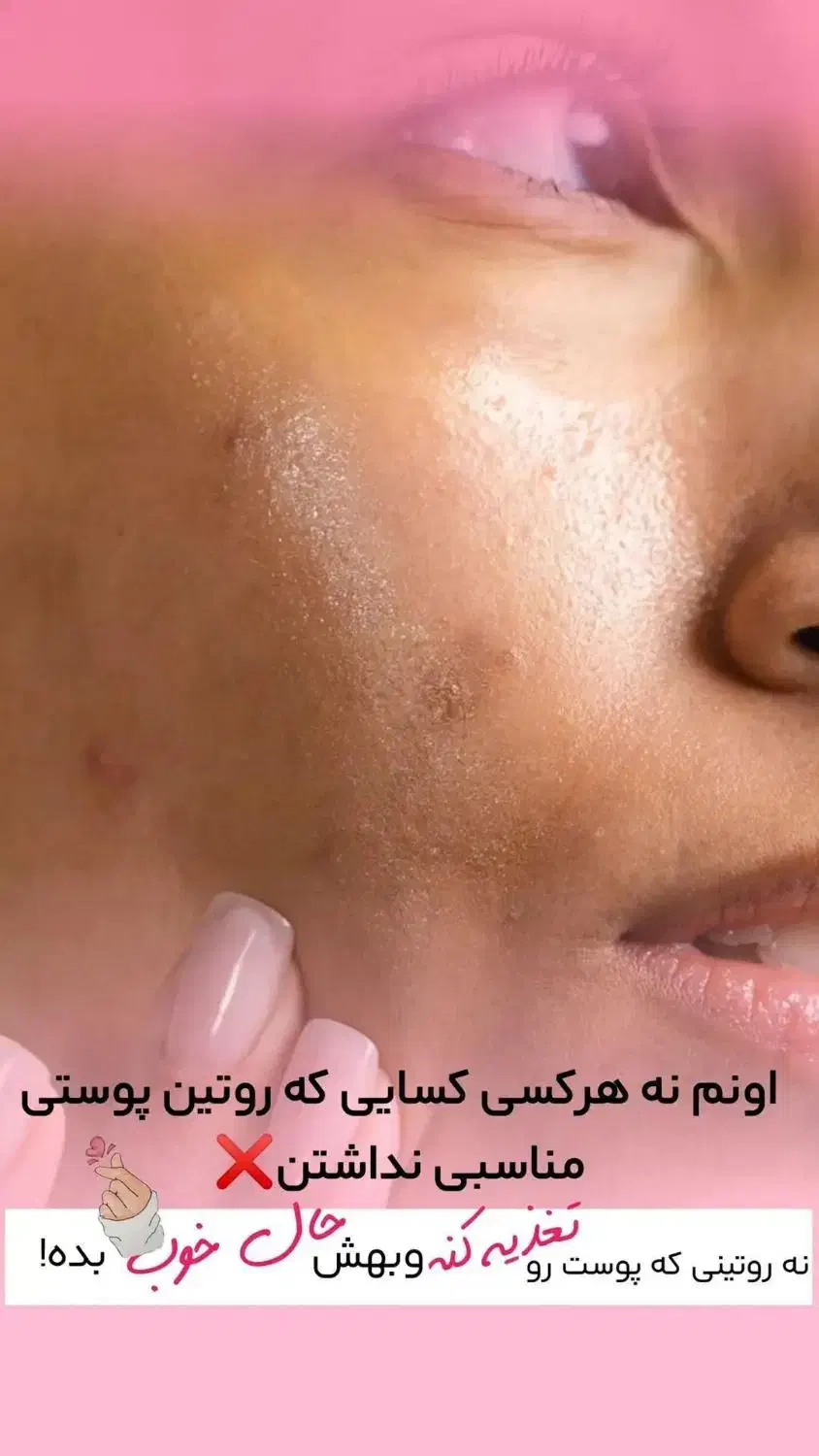 راهنمایی برای پوست|فعالیت داوطلبانه|قم, زنبیل آباد|دیوار