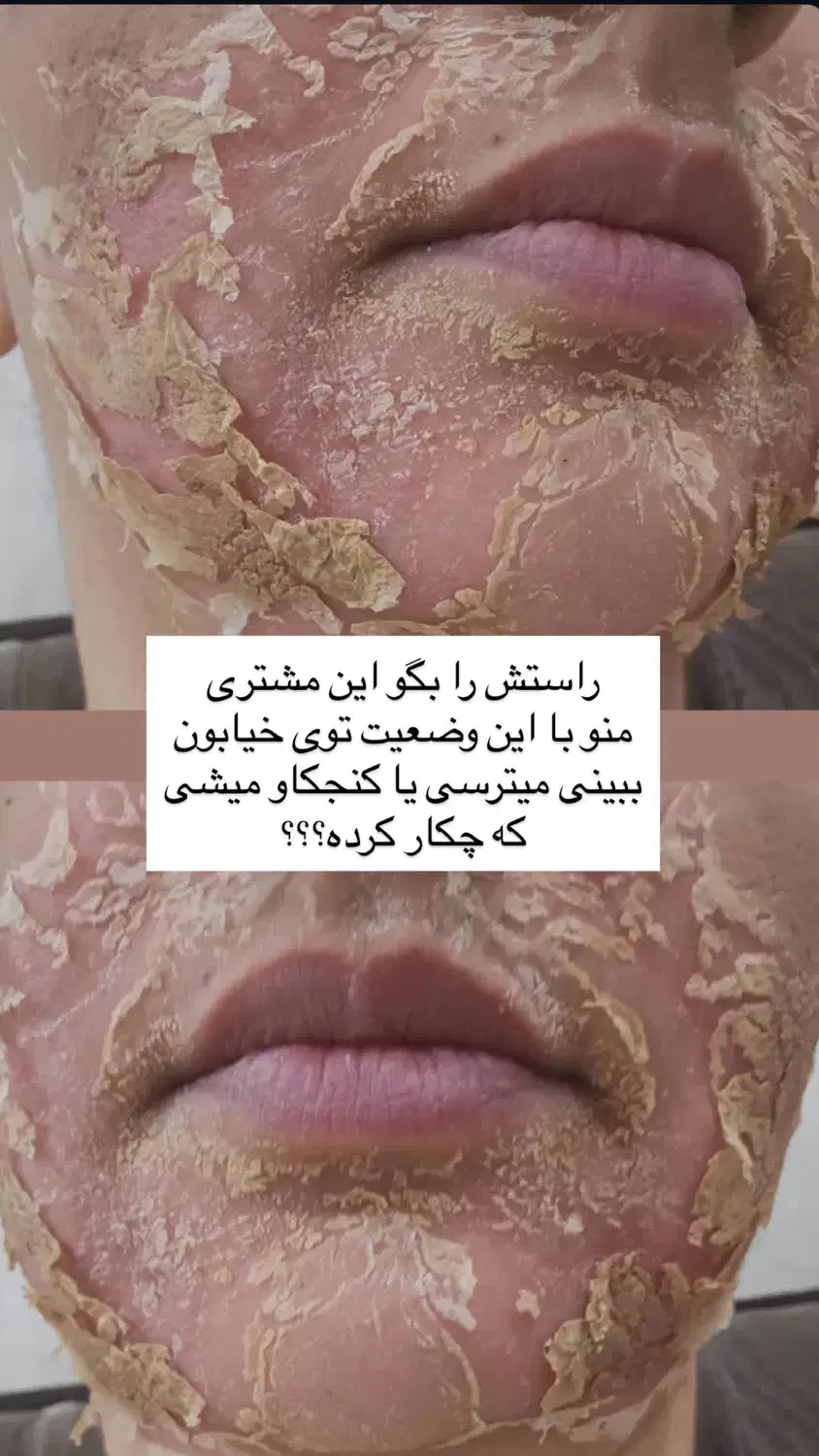 پوست روشن را از ما بخواهید|خدمات آرایشگری و زیبایی|رشت, گلسار|دیوار