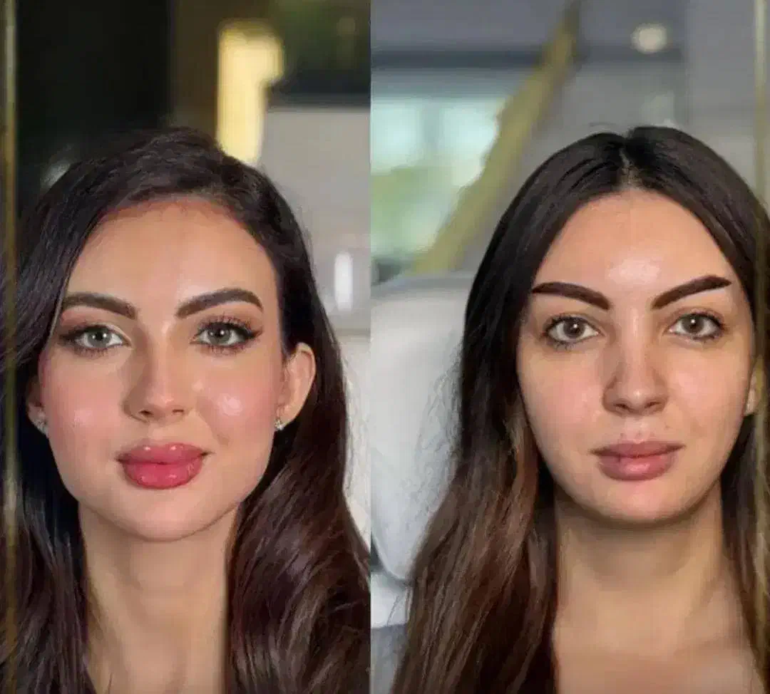 تخفیفات یلدایی ،مدل رایگان ،کلینیک دارای ۳شعبه|خدمات آرایشگری و زیبایی|شهریار, شهرک بهاران (ویره)|دیوار