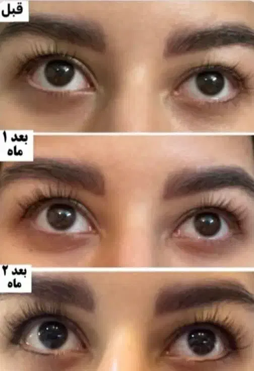 درمان ریزش مو و لک پوستی با محصولات اصل تراست|آرایشی، بهداشتی، درمانی|قدس, شهر‌قدس|دیوار