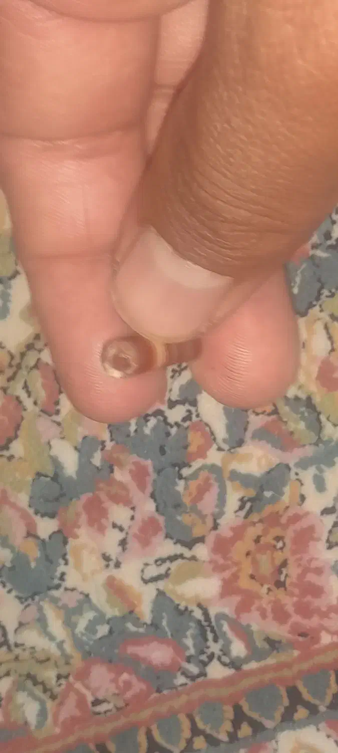 سنگ زیبا سوراخی|کلکسیون اشیاء عتیقه|زاهدان, |دیوار