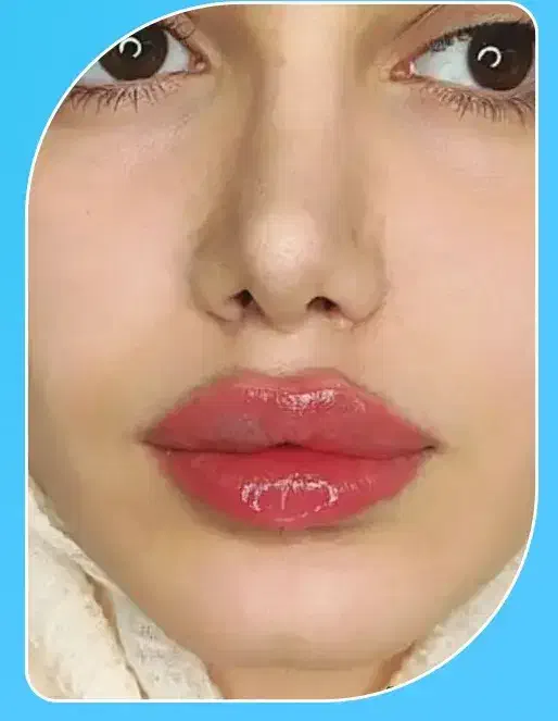 اف ۵۰٪ژل و بوتاکس و مزو...|خدمات آرایشگری و زیبایی|اهواز, اهواز|دیوار