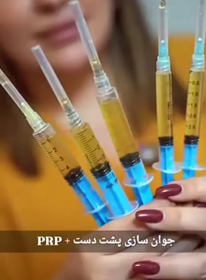 فیلرباسن هیپ دیپ ۱۲۰سیسی ۱۲میلیون تا آخر مهر|آرایشی، بهداشتی، درمانی|تبریز, |دیوار