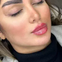 آف  ۸۰۰و۹۰۰ تا ۱/۵۰۰تزریق ژل و بوتاکس