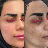 کرم بیوممتیک ضمانت اصل پرداخت درب منزل