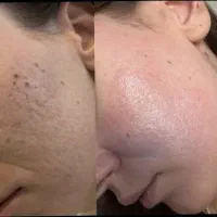 آموزش فیشال مبتدی و پیشرفته