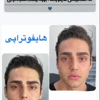 هایفوجوانساز