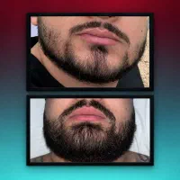 رمز مرد های که ریش جذاب دارن چیه