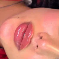 تزریق فیلر وبوتاکس مزو آنزیم پی ارپی و چربی|خدمات آرایشگری و زیبایی|کرمانشاه, |دیوار