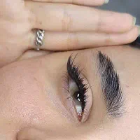 کاشت مژه هیدن تلفیقی