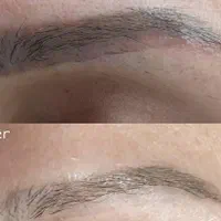 ۴۰٪ تخفیف پاک کردن تتو و خالکوبی با لیزرQ-switch|خدمات آرایشگری و زیبایی|کرمانشاه, |دیوار