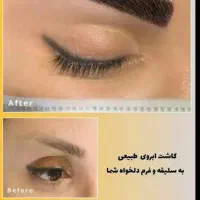 / کاشت مو و ابرو /بلفارو/ /عمل بینی ژل وبوتاکس|خدمات آرایشگری و زیبایی|تهران, دکتر هوشیار|دیوار