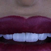 کامپوزیت دندان فکی ۸میلیون|خدمات آرایشگری و زیبایی|پرند, فاز ۰|دیوار