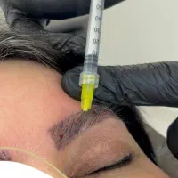 اموزش لیزر. مزوتراپی. کربوکسی تراپی|خدمات آموزشی|کرمان, |دیوار