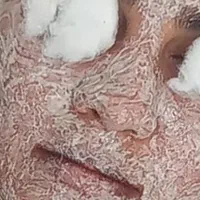 تخفیف خدمات درمان تخصصی پوست.فشیال پاکسازی جوانساز|خدمات آرایشگری و زیبایی|میاندوآب, |دیوار
