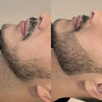 پی ار پی ممنوع