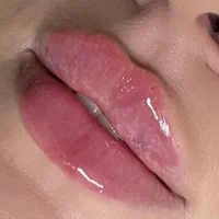 خدمات ژل و بوتاکس ، مزوتراپی سر و صورت