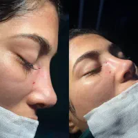 مژه|خدمات زیبایی و سلامت|دزفول, |دیوار
