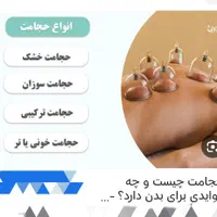 حجامت.بادکشی.رگ گیری .درمان رماتیس وسیاتیک تضمینی