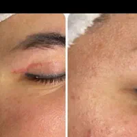 فیشال تخصصی کلینیکی آقایان وبانوان آموزش آقاوخانم|خدمات آرایشگری و زیبایی|بندرعباس, |دیوار