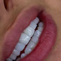 دستیار دندانپزشک