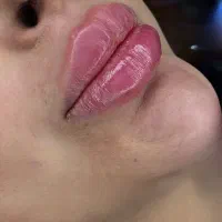 تزریق فیلر لب گونه بوتاکس پاک کردن تتو|خدمات آرایشگری و زیبایی|تهران, یافت آباد شمالی|دیوار
