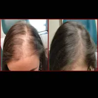 آموزش اسکالپ کف سر و فشیال پوست و کراتین ابریشمی|خدمات آموزشی|خمینی‌شهر, |دیوار