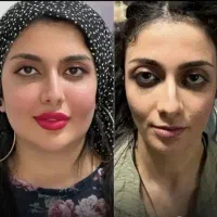 تزریق تخصصی ژل وبوتاکس،چربی،هایفو،نخ،توسط پزشک|خدمات آرایشگری و زیبایی|کرمانشاه, |دیوار