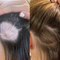 ویتامین رسانی ریشه و ساقه