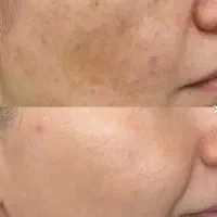 prp|خدمات آرایشگری و زیبایی|یزد, |دیوار