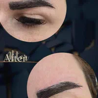 پاک کردن تتو صورت و بدن با دستگاه لیزر کیوسوییچ|خدمات آرایشگری و زیبایی|فلاورجان, |دیوار