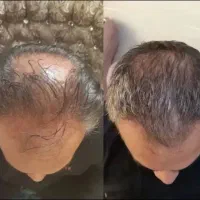 درستش می کنیم