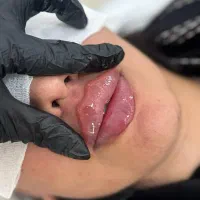 آموزش ژل و بوتاکس ولاغری/آموزش پاکسازی و پوست