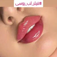 خدمات بوتاکس فیلر مزو ژل prp