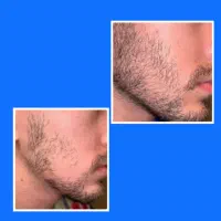 بردپیت شو|آرایشی، بهداشتی، درمانی|تخت سلیمان, |دیوار