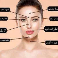 مدل بوتاکس(چشم گربه ایی)|خدمات آرایشگری و زیبایی|قم, بنیاد|دیوار