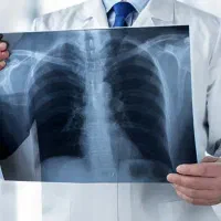 ضایعات عکس و فیلم رادیولوژی درمحل با ترازودیجیتال