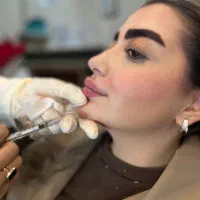 خدمات زیبایی بوتاکس.تزریق فیلر و مزو ژل جوانساز