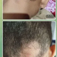مشاور طب سنتی|آرایشی، بهداشتی، درمانی|شهرکرد, |دیوار