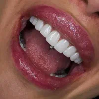 کامپوزیت ویژه آف 40٪ با ضمانت‌نامه