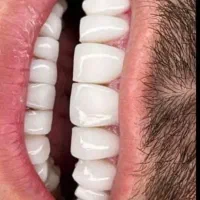 طرف قرارداد با بیمه ها/قیمت استثنایی/باکیفیت|خدمات آرایشگری و زیبایی|شیراز, ملاصدرا|دیوار