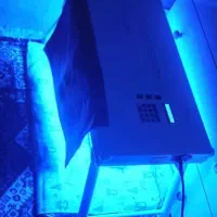 اجاره دستگاه زردی فتوتراپی نوزاد