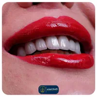 منشی و کال سنتر دندانپزشکی|استخدام درمانی، زیبایی، بهداشتی|تهران, خرمشهر|دیوار