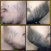 رویش ریش و سبیل و مو سر صد در صد گیاهی